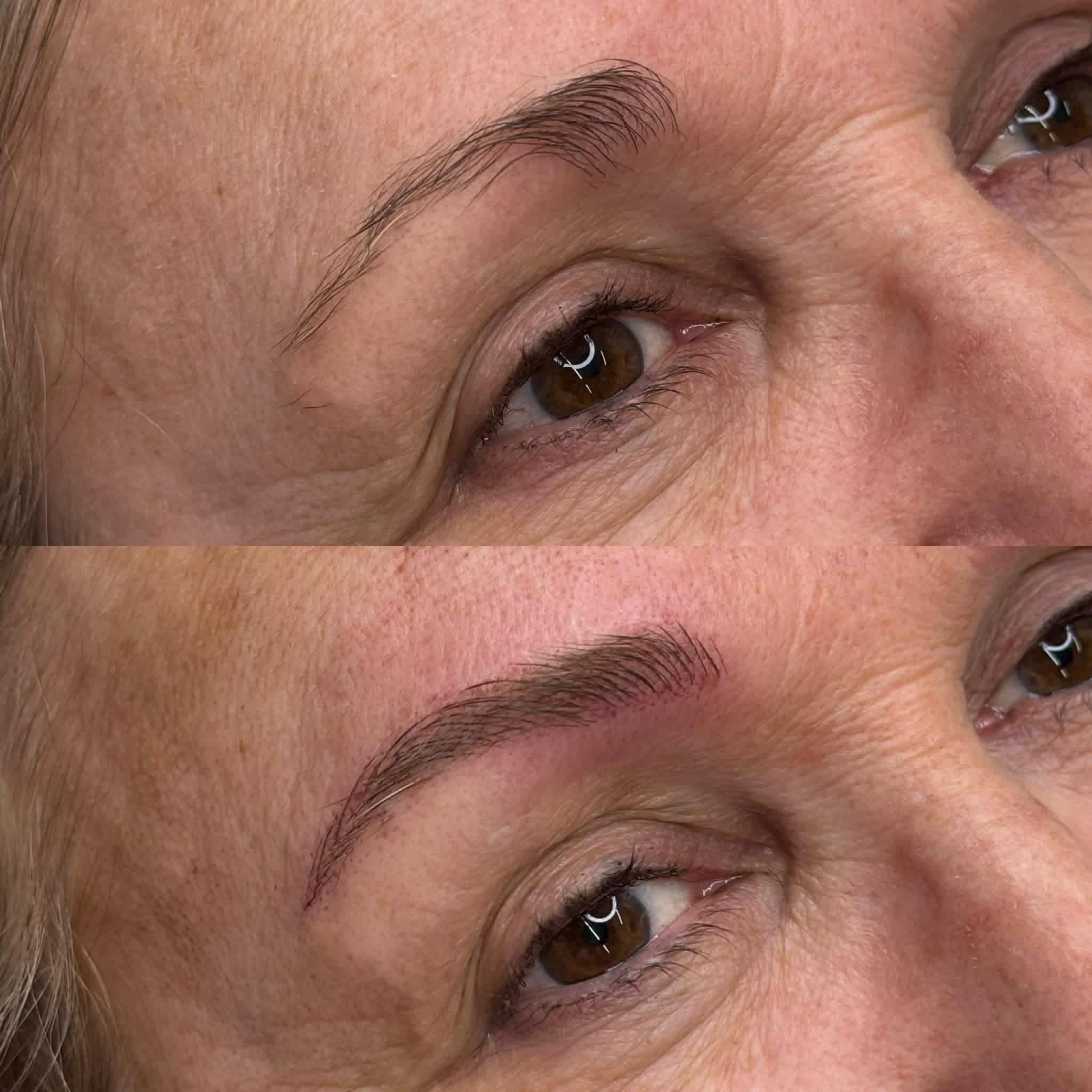 MICROPIGMENTATION