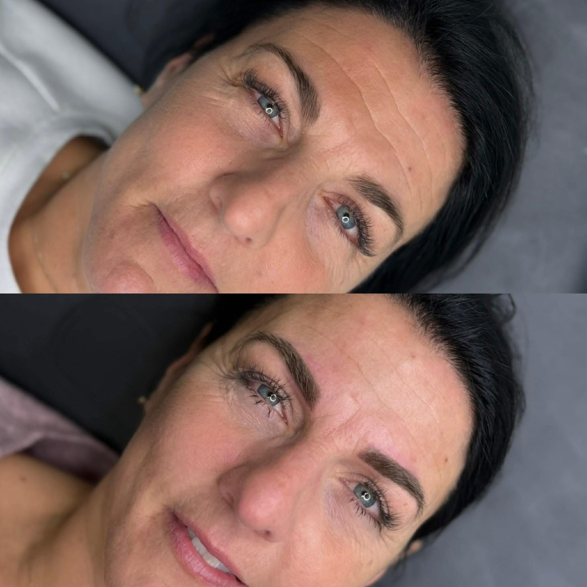 MICROPIGMENTATION
